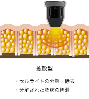 拡散型